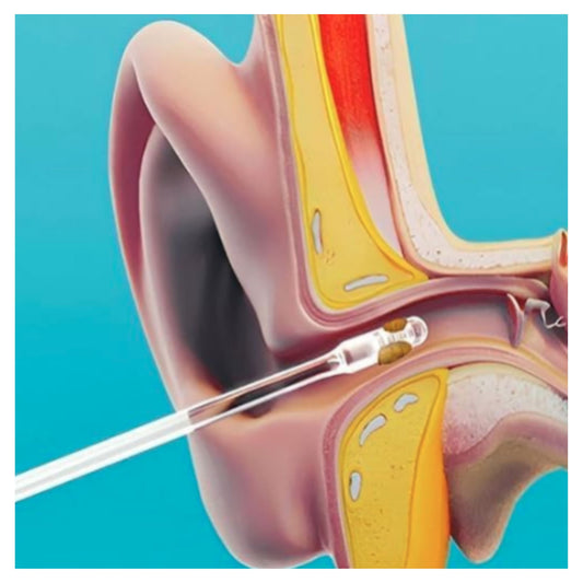 Ear Warning Removal Tool, Earwax Remover for Elderly Adults